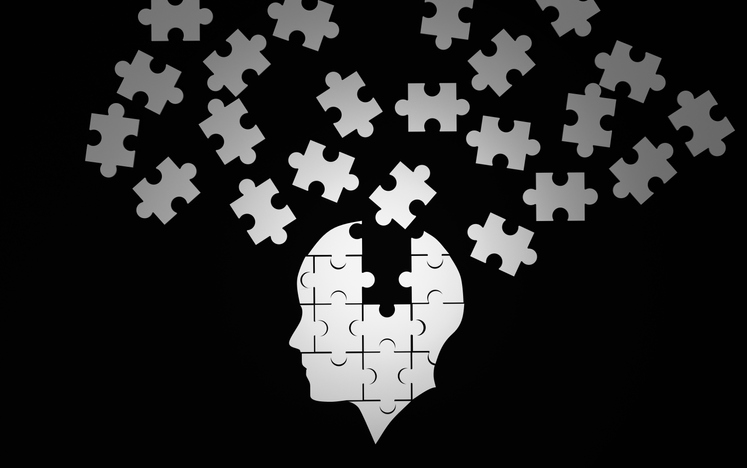 White jigsaw puzzle as a human brain on black. Concept for Alzheimer's disease. 3d illustration